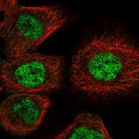 Anti-GUCD1 antibody produced in rabbit HPA022786-100UL