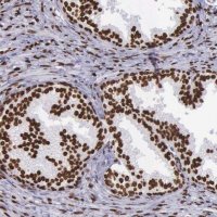 Anti-H1F0 antibody produced in rabbit HPA000843-100UL