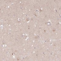 Anti-HAL antibody produced in rabbit 