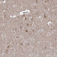 Anti-HARS antibody produced in rabbit 