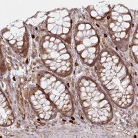 Anti-HARS2 antibody produced in rabbit HPA035941-100UL