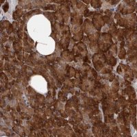 Anti-HBS1L antibody produced in rabbit 