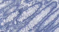 Anti-HCF-1 Antibody, clone 1B17 ZooMAb Rabbit Monoclonal 