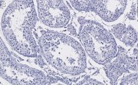 Anti-HDAC2 Antibody, clone 1E22 ZooMAb Rabbit Monoclonal 