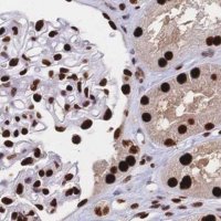 Anti-HDGF antibody produced in rabbit 