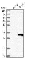 Anti-HDHD3 antibody produced in rabbit 