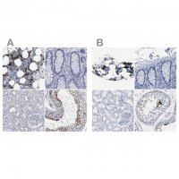 Anti-HEMGN antibody produced in rabbit 