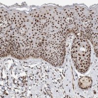 Anti-HESX1 antibody produced in rabbit 