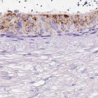 Anti-HEXB antibody produced in rabbit 