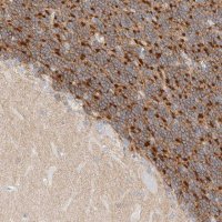 Anti-HEXDC antibody produced in rabbit 