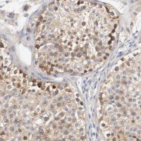 Anti-HGS antibody produced in rabbit 