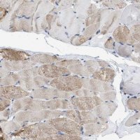 Anti-HHATL antibody produced in rabbit 