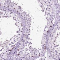 Anti-HHIPL2 antibody produced in rabbit 