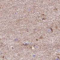 Anti-HIP1R antibody produced in rabbit 