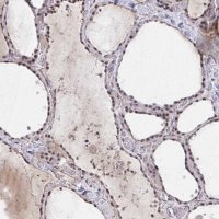 Anti-HIRA antibody produced in rabbit 