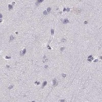 Anti-HIST1H1T antibody produced in rabbit 