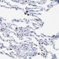 Anti-HLA-DQA1 antibody produced in rabbit 