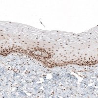 Anti-HLTF antibody produced in rabbit 