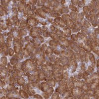 Anti-HM13 antibody produced in rabbit HPA045089-100UL