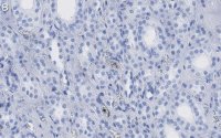 Anti-HNF-1 Antibody, clone 1M22 ZooMAb Rabbit Monoclonal 