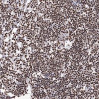 Anti-HNRNPM antibody produced in rabbit HPA024344-100UL