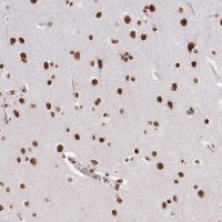 Anti-HNRNPU antibody produced in rabbit HPA058707-100UL