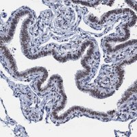 Anti-HNRNPUL2 antibody produced in rabbit HPA041632-100UL
