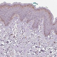 Anti-HOPX antibody produced in rabbit 