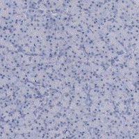 Anti-HORMAD1 antibody produced in rabbit 