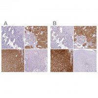 Anti-HPD antibody produced in rabbit 