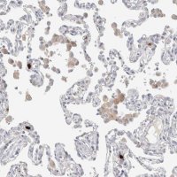 Anti-HPGDS antibody produced in rabbit 