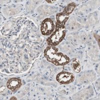 Anti-HPRT1 antibody produced in rabbit 
