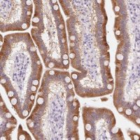 Anti-HSD17B2 antibody produced in rabbit 