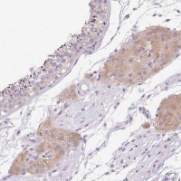 Anti-HSD17B3 antibody produced in rabbit 