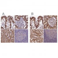 Anti-HSDL2 antibody produced in rabbit 