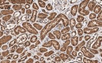 Anti-HSP60 Antibody, clone 1N3, ZooMAb Rabbit Monoclonal 