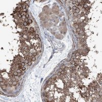 Anti-HSPB11 antibody produced in rabbit HPA030140-100UL