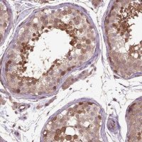 Anti-HSPBP1 antibody produced in rabbit 