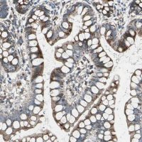 Anti-HTATIP2 antibody produced in rabbit HPA006417-100UL