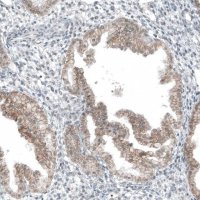 Anti-HTR1E antibody produced in rabbit 