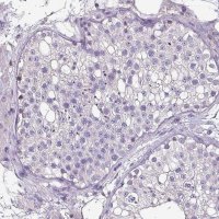 Anti-HTRA4 antibody produced in rabbit 