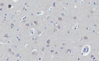 Anti-Huntingtin Protein Antibody, clone 1M11, ZooMAb Rabbit Monoclonal 