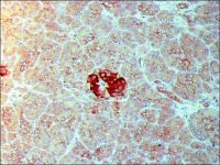 Anti-IAPP (N-terminal) antibody produced in rabbit SAB4200494-200UL