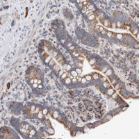 Anti-IARS2 antibody produced in rabbit HPA024596-100UL