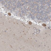 Anti-ICMT antibody produced in rabbit 