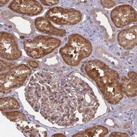 Anti-IFIT3 antibody produced in rabbit 