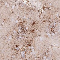 Anti-IFIT5 antibody produced in rabbit 