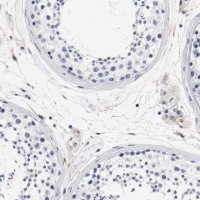 Anti-IFITM1 antibody produced in rabbit 