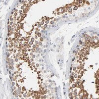 Anti-IFT43 antibody produced in rabbit 