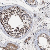 Anti-IFT81 antibody produced in rabbit 